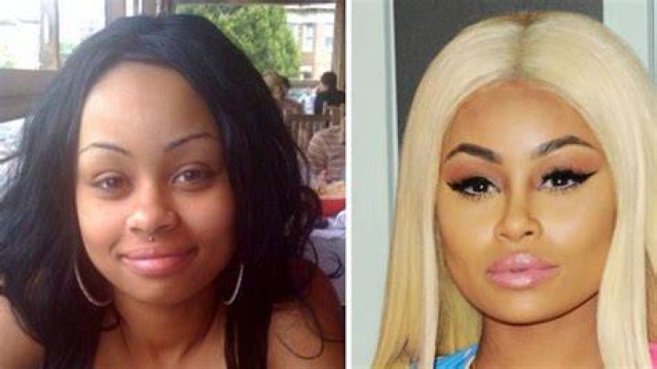Blac Chyna Before Plastic Surgery: Uncovering Hidden Truths