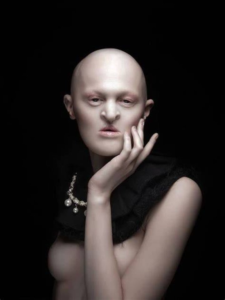 Meet Melanie Gaydos, 28YearOld Model With A Rare Disorder Who